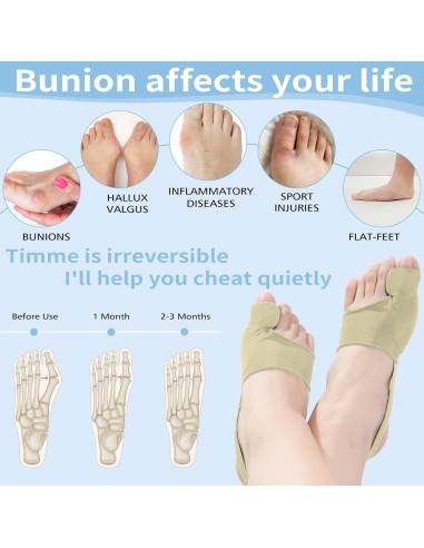 Corrector de Juanetes ZORVOKE 2 Piezas Alivio Dolor