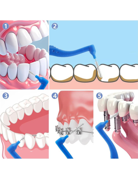 50 Cepillos Interdentales Lanjue Azul Mango Antideslizante