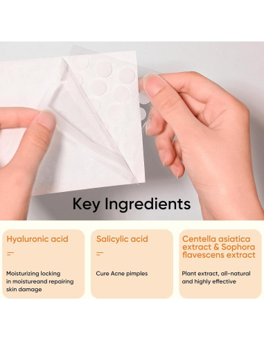 Parche para Acné Rulvcian - 54 Unidades, Microdart y Ácido Salicílico
