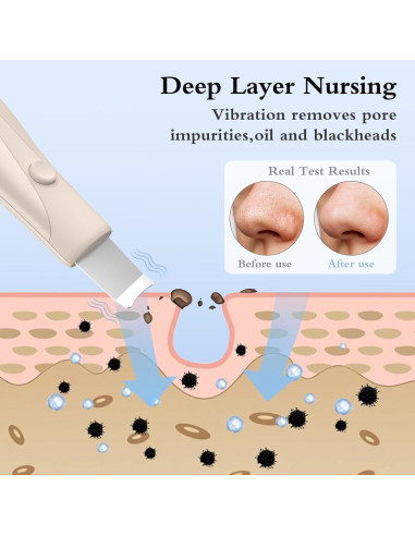 Espátula Limpiadora de Piel LRUFOB para Cuidado Facial Beige