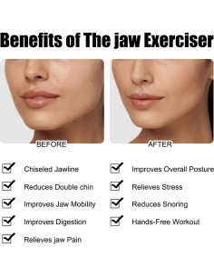 Ejercitador de Mandíbula Panthra 12 Piezas Silicona 2