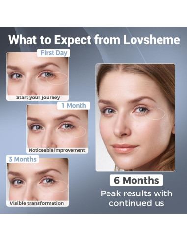 Máscara de Terapia de Luz Roja Inalámbrica Lovsheme 320 LEDs 4 Modos