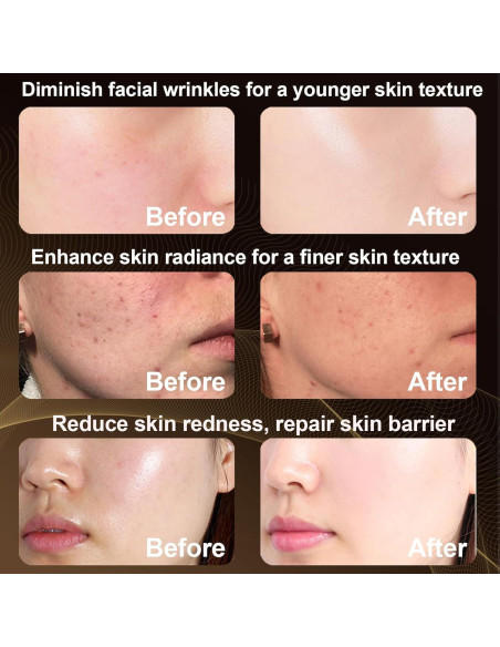 Máscara de Terapia de Luz Roja Fastfafa 850nm Portátil