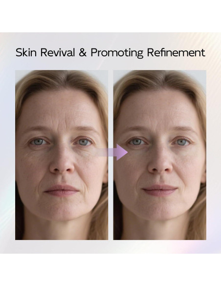 Máscara de Terapia de Luz Roja Zippy Goose 850nm LED Facial