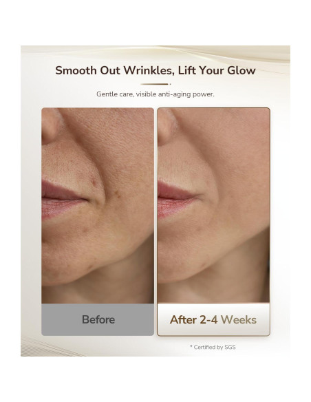 Máscara Lásers JOVS 4D Terapia Luz Roja 850nm Antienvejecimiento Máscara Lásers JOVS 4D Terapia Luz Roja 850nm Antienvejecimiento