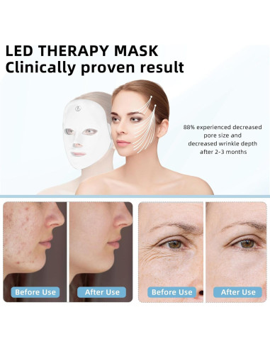 Máscara Facial LED KNNKNN Terapia de Luz 7 Colores Portátil
