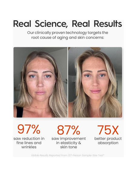 Masajeador Facial REVO Genie con Terapia LED para Arrugas