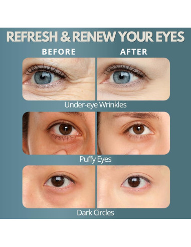 Masajeador de Ojos Zeencare con Terapia de Luz Roja