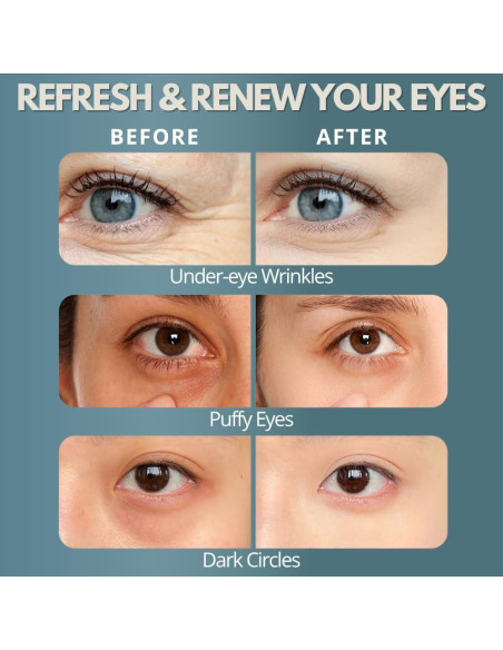 Masajeador de Ojos Zeencare con Terapia de Luz Roja