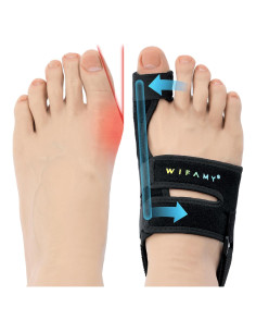 Corrector de Juanetes Wifamy para Dedo Gordo - Alivio del Dolor