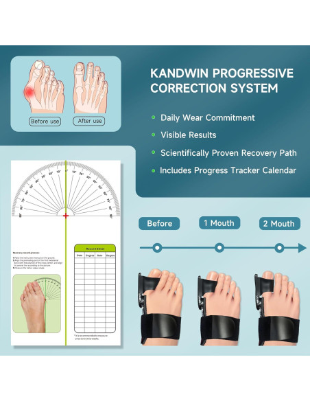 Corrector de Juanetes Kandwin BC-01-B para Alivio del Dolor