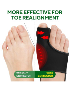 Corrector de Juanetes TECKED - Alivio para Hallux Valgus Negro 2