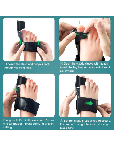 Corrector de Juanetes Kandwin BC-01-B para Alivio del Dolor