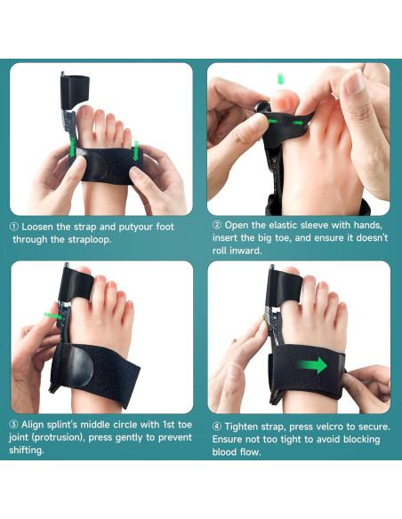 Corrector de Juanetes Kandwin BC-01-B para Alivio del Dolor