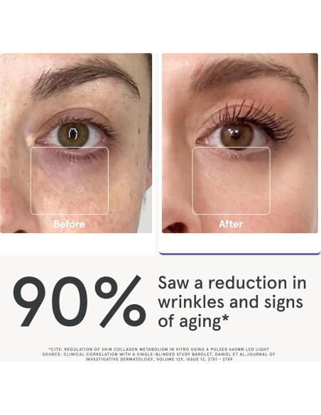 iRestore Máscara de Luz Roja para Ojos - 180 LEDs, Antiarrugas