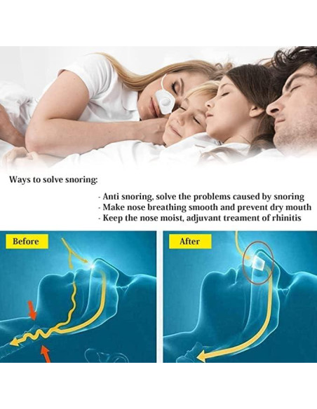 Dispositivo Anti Ronquidos 4 en 1 HDSMNGY con Atomización Dispositivo Anti Ronquidos 4 en 1 HDSMNGY con Atomización