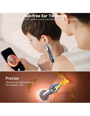 Limpiador de Oído Bebird R1 Ultra con Cámara y Pinzas
