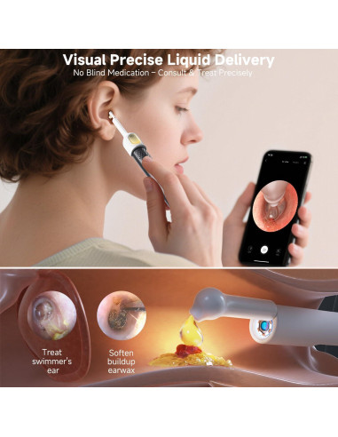 Limpiador de Oído Bebird R1 Ultra con Cámara y Pinzas