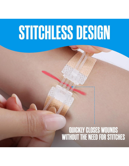 Tiras de Cierre de Heridas Houseables, Kit de 4 Unidades