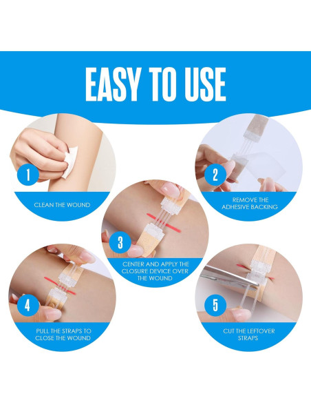 Tiras de Cierre de Heridas Houseables, Kit de 4 Unidades