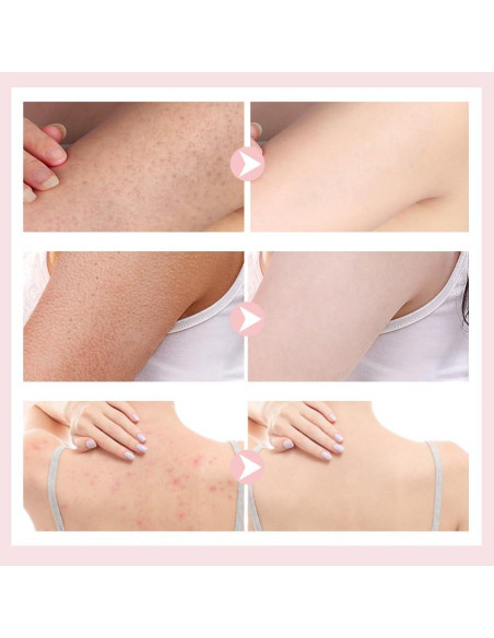 Esponja de Baño Flor YAWOTA 2 Pcs Suave con Ventosa Esponja de Baño Flor YAWOTA 2 Pcs Suave con Ventosa