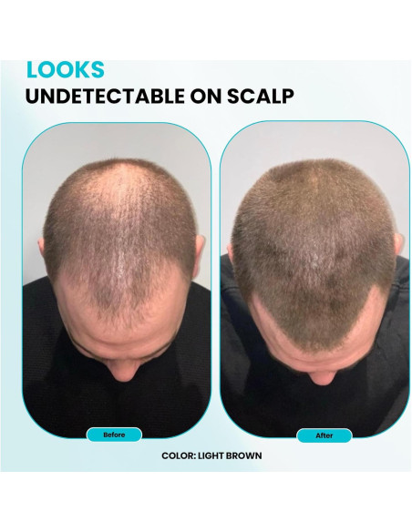 Fibras para Cabello SureThik 30g Marrón Oscuro Natural