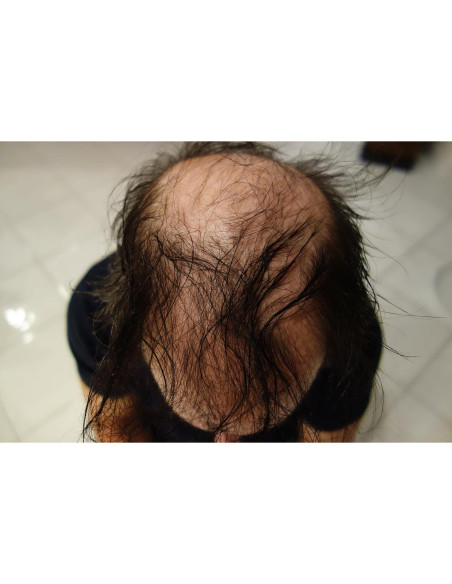 Fibras para Cabello Finally Hair Marrón Oscuro 28g