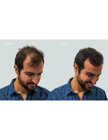 Fibras Capilares Maxx Pro-Series con Keratina 25g Marrón Oscuro Fibras Capilares Maxx Pro-Series con Keratina 25g Marrón Oscuro