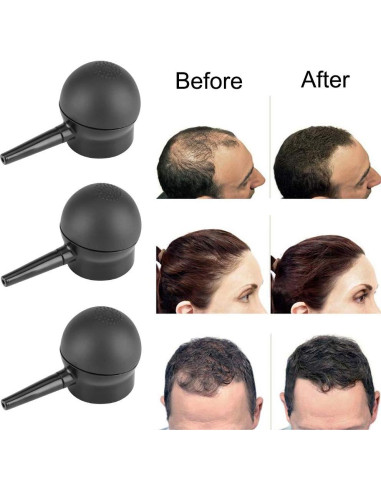 Fibras para Cabello MQX 36g - Engrosador para Hombres y Mujeres