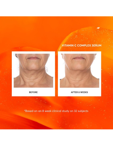 Suero Facial Naturium Vitamina C 28g Antienvejecimiento