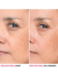 Suero de Ácido Hialurónico IT Cosmetics 29.57 ml - Hidratante 2