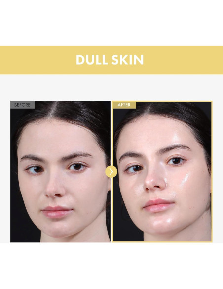 Esencia Facial Tosowoong Frijol Brillante 33ml Hidratante Exfoliante