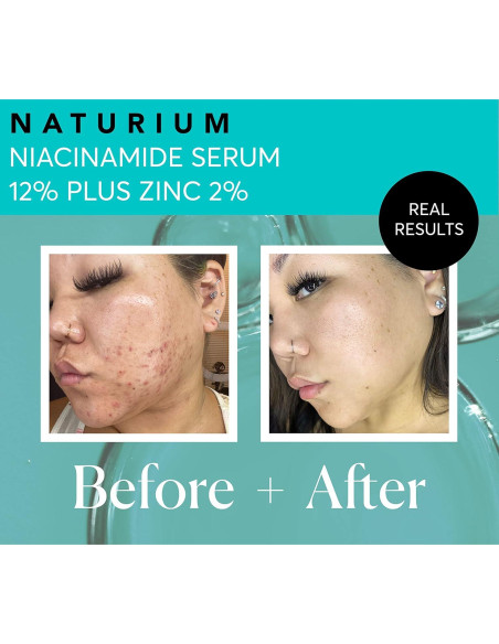 Suero Facial Naturium 12% Niacinamida y 2% Zinc 28g