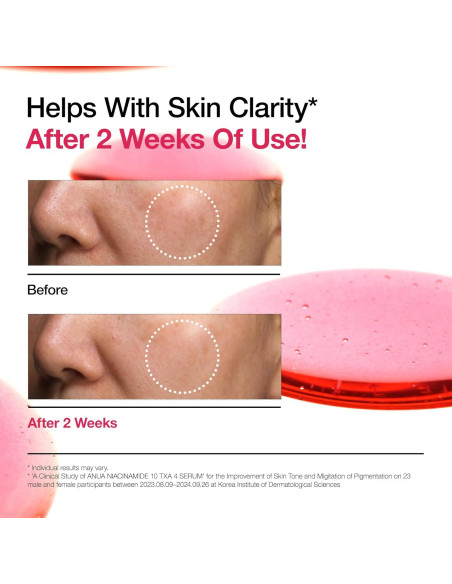 Suero Facial ANUA Niacinamida 10% y Ácido Tranexámico 30ml