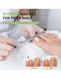 Lima de Uñas Gruesas BALUCA con Elevador para Uñas Encarnadas 2