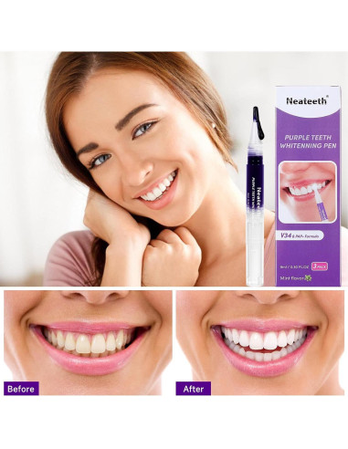 Lápiz Blanqueador de Dientes Neateeth Morado 3 Paquetes