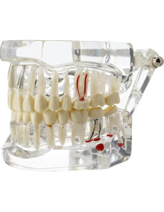 Modelo Dental Typodont Implantológico Dentalmall 2001C 2