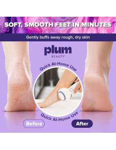 Lima eléctrica para pies AmazonUs, portátil, 1 cuenta 2