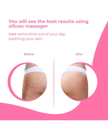 Rodillo Masajeador Anticelulitis Avalon 13.68x9.60cm