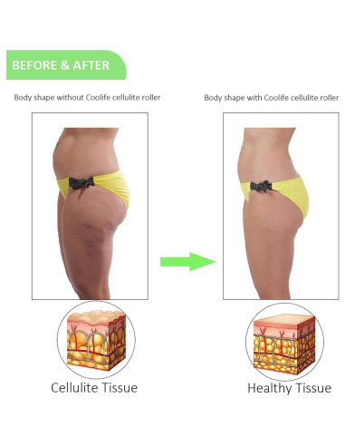 Rodillo de Fascia Coolife 3 Bolas para Masaje Muscular