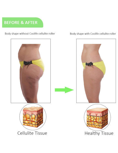 Rodillo de Fascia Coolife 3 Bolas para Masaje Muscular