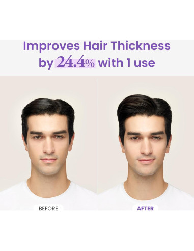 Tónico de Aceite de Romero y Menta Dr.Groot 100ml - Crecimiento Cabello