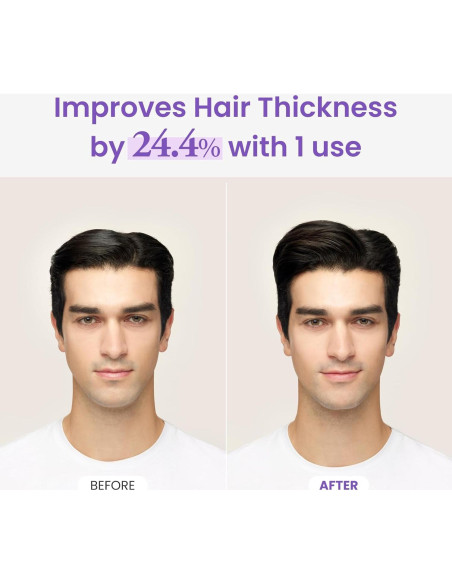 Tónico de Aceite de Romero y Menta Dr.Groot 100ml - Crecimiento Cabello