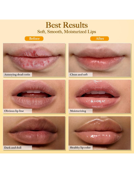 Juego de Exfoliación Labial MUREND 3 Piezas Cúrcuma y Limón