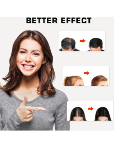 Gorra de Crecimiento de Cabello Viconor con Láser Negra 2