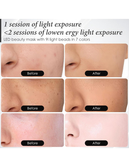 Máscara LED Terapia Facial Sunpint 7 Colores Comodidad en Casa