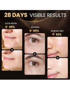 Máscara LED Lovsheme para Rejuvenecimiento Facial 320 LEDs 2