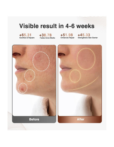 Terapia de Luz Roja JOVS para la Cara - Dispositivo LED Inalámbrico