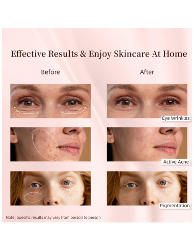 Máquina de Terapia de Luz LED MOLAMOYA 8 en 1 para Cara y Cuerpo