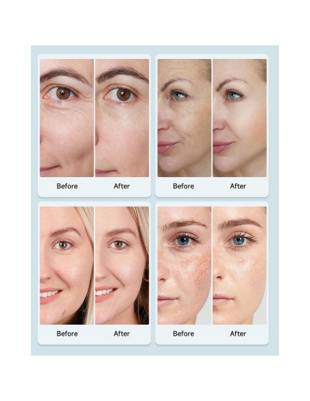 Máscara de Terapia de Luz LED MOLAMOYA 7 Colores Facial